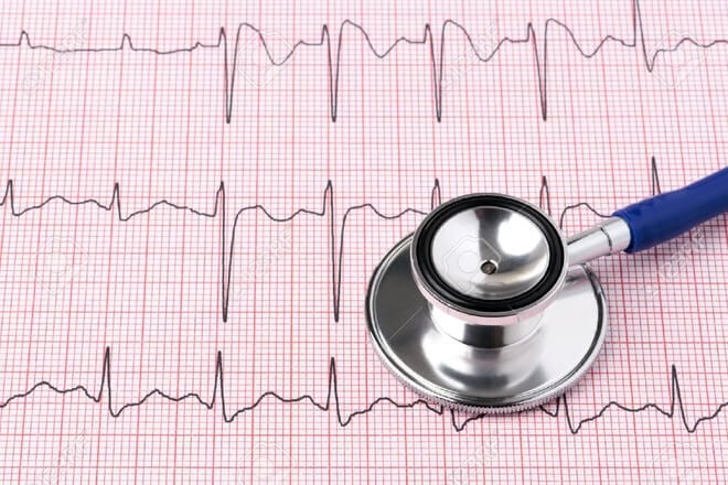 Otkucaji srca – normalne, visoke i niske vrijednosti