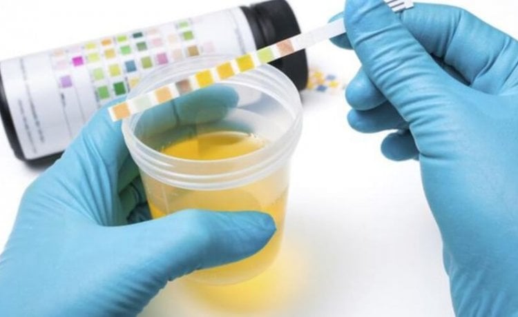 Homeopátiás gyógyszerek a magas vizeletben és cystitisben szenvedő leukociták ellen