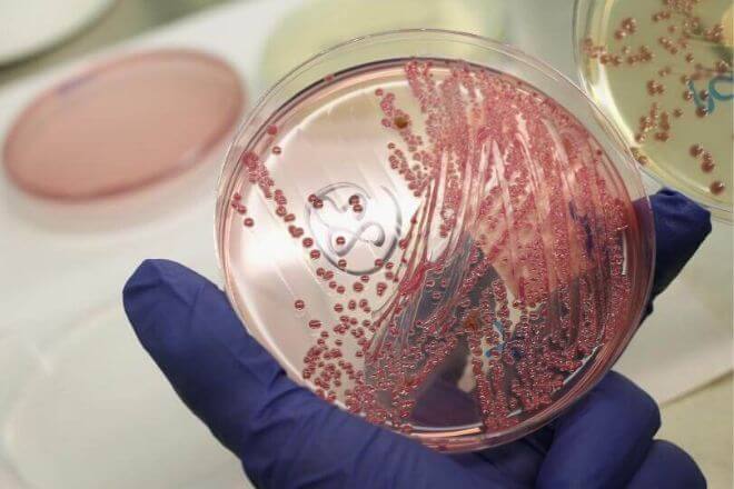 Az e-coli okoz-e fogyást. Húgyúti fertőzés