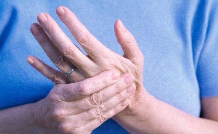 u liječenju artritisa ruke