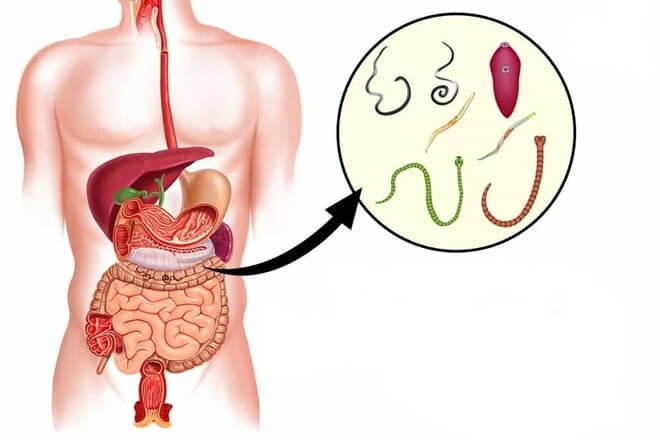crijevni paraziti kod ljudi simptomi limbrici in timpul sarcinii
